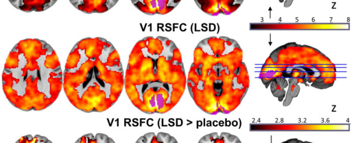 en_lsd